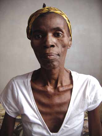 Selinah: Recovery through ARV therapy